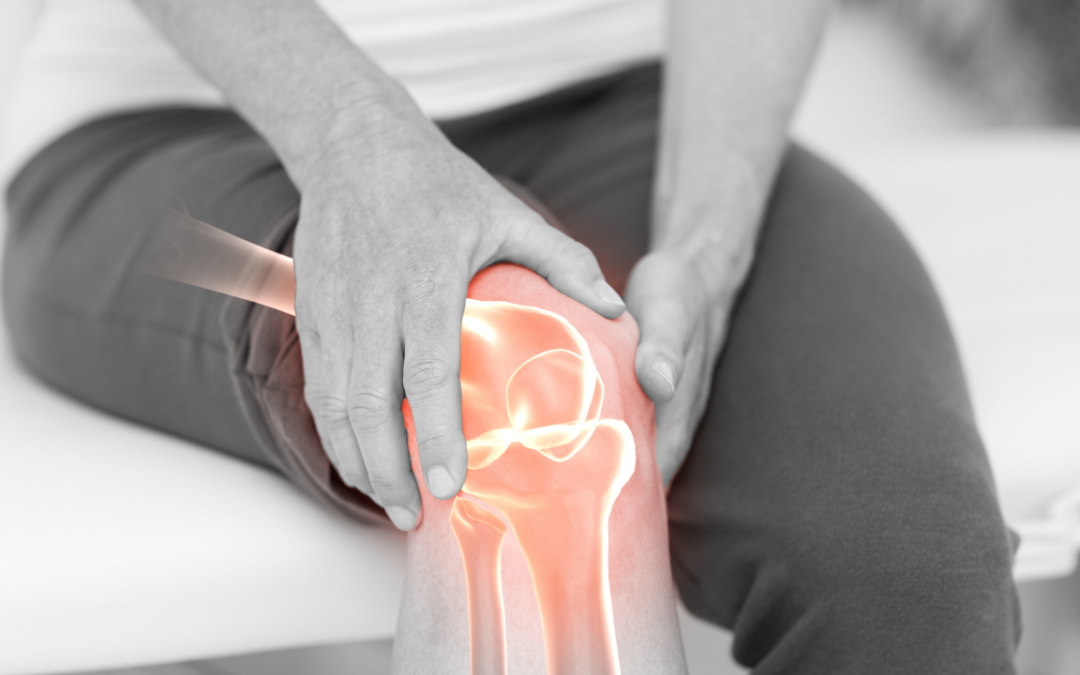 3 Ways to Improve Your Knee Arthritis